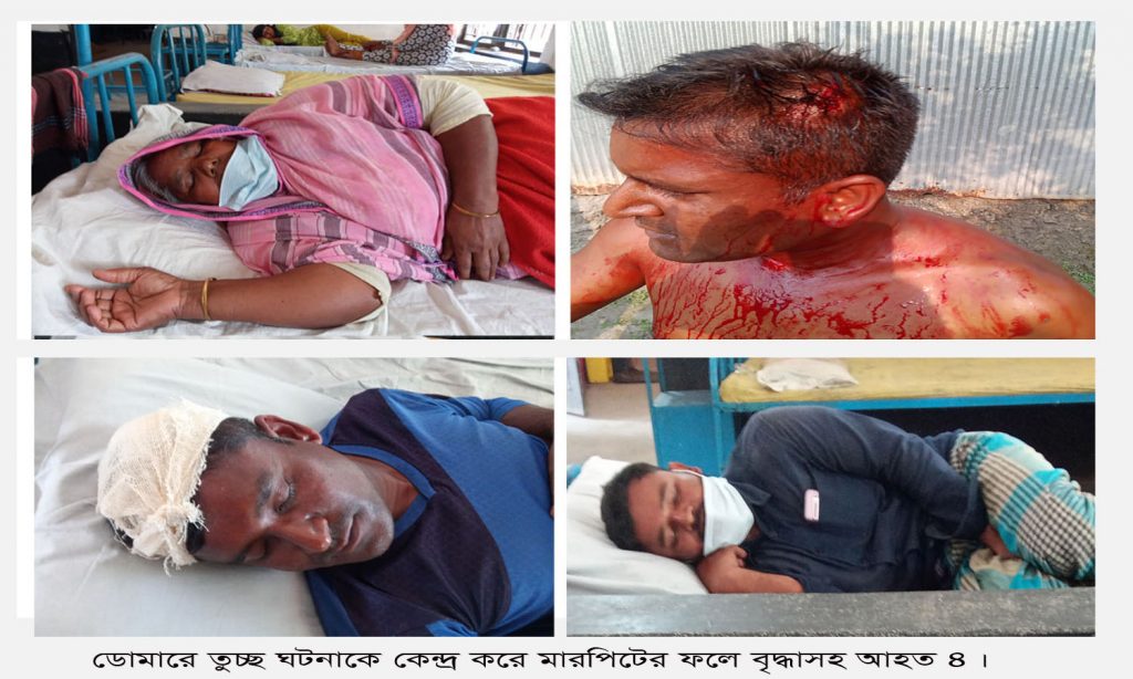ডোমারে তুচ্ছ ঘটনাকে কেন্দ্র করে মারপিট, বৃদ্ধাসহ আহত ৪