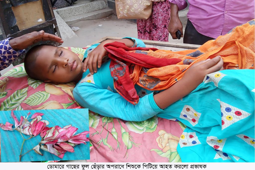 ডোমারে গাছের ফুল ছেঁড়ার অপরাধে শিশুকে পিটিয়ে আহত করলো প্রভাষক