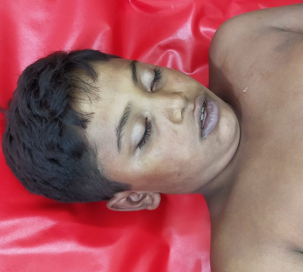 তিতাসে সাপের কামড়ে ছাত্রের মৃত্যু