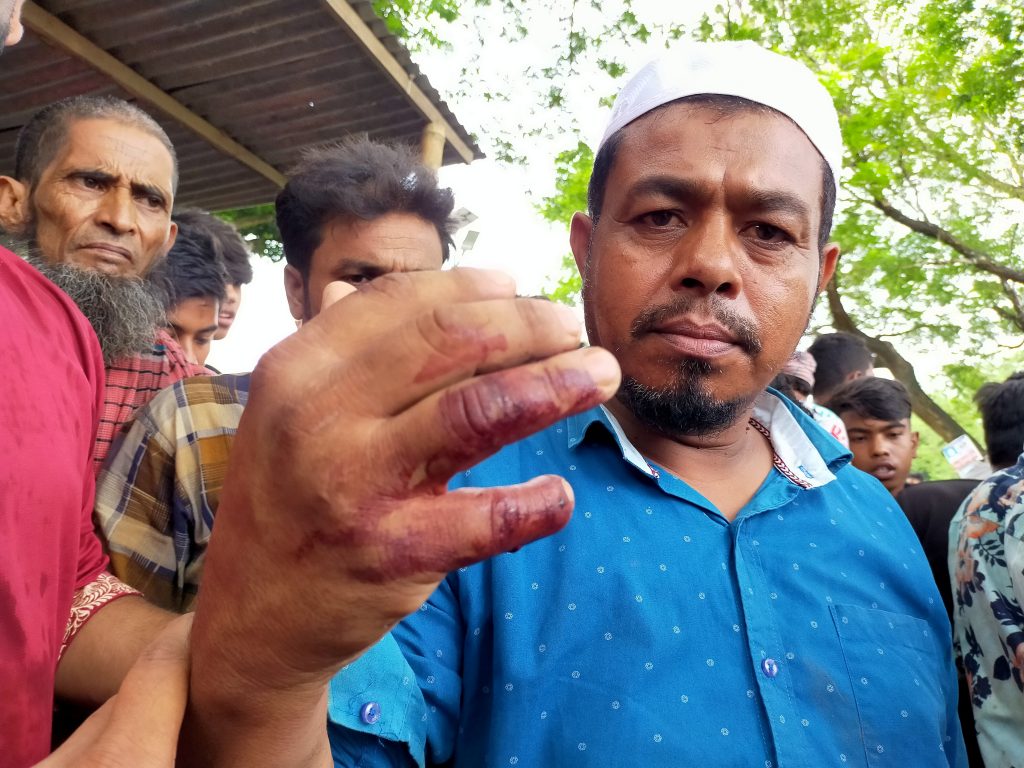 হোমনায় গায়ে হলুদের অনুষ্ঠানে ছবি তুলতে না দেওয়ায় ২ গ্রামবাসীর সংঘর্ষে আহত ২০, গ্রেফতার ১