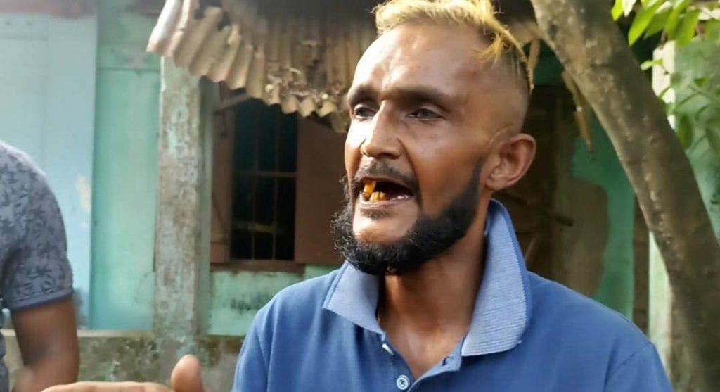 জগন্নাথপুরে যুক্তরাজ্য প্রবাসীর উপর সং’ঘবদ্ধ হা’মলা, থানায় অভিযোগ 