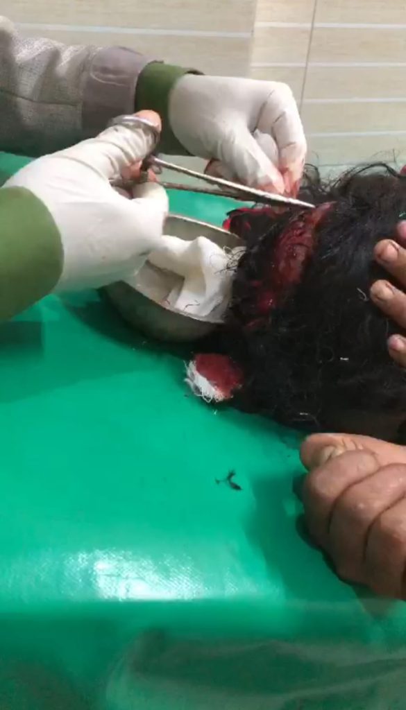 তিতাসে মাটি কাটতে বাধা দেওয়ায় গৃহবধূকে র*ক্তাক্ত জখম ও শ্লী*লতাহানি