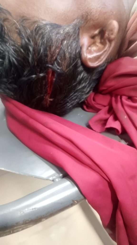 কিশোরগঞ্জে ‎বসতবাড়ির প্রবেশপথ নিয়ে বিরোধের জেরে রাজমিস্ত্রিকে কু*পিয়ে জখম, থানায় মামলা