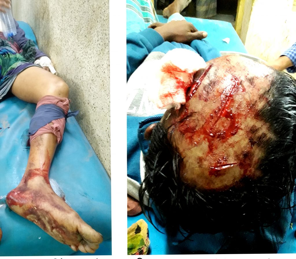 হোমনায় আধিপত্য বিস্তারকে কেন্দ্র করে দুই গ্রুপের সংঘর্ষে  আহত ১৫, ১জনকে ঢাকায় রেফার্ড